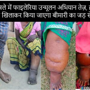 जशपुर जिले में फाइलेरिया उन्मूलन अभियान तेज़, हर व्यक्ति को दवा खिलाकर किया जाएगा बीमारी का जड़ से खात्मा