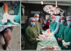 सिम्स बिलासपुर में चिकित्सा क्षेत्र की बड़ी उपलब्धि: 5 वर्षीय बच्चे के जन्मजात घुटने की कटोरी के डिस्लोकेशन का पहली बार सफल ऑपरेशन, आयुष्मान योजना के तहत मिला निःशुल्क उपचार