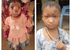पिता के निधन और आर्थिक संकट के बीच उम्मीद बनी चिरायु योजना — बस्तर की मासूम अंजलि को मिला नया जीवन, जटिल ट्यूमर सर्जरी से खिली फिर मुस्कान