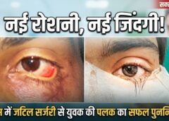 सिम्स बिलासपुर में चिकित्सा का कमाल—स्किन ग्राफ्टिंग से युवक की क्षतिग्रस्त पलक का सफल पुनर्निर्माण, जटिल सर्जरी के बाद लौटी दृष्टि और सामान्य जीवन की उम्मीद