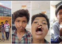 15 साल का इंतजार हुआ खत्म! सरकारी योजना से निःशुल्क सर्जरी, माड़कम हुंगा को मिला नया जीवन और नया आत्मविश्वास